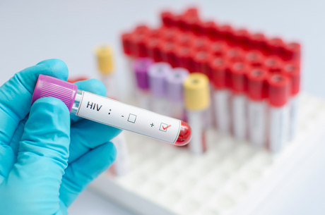 Vacina contra HIV começa a ser testada em humanos