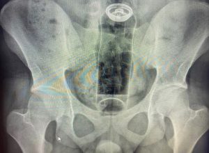 WhatsApp Image 2026-01-26 at 13.36.50